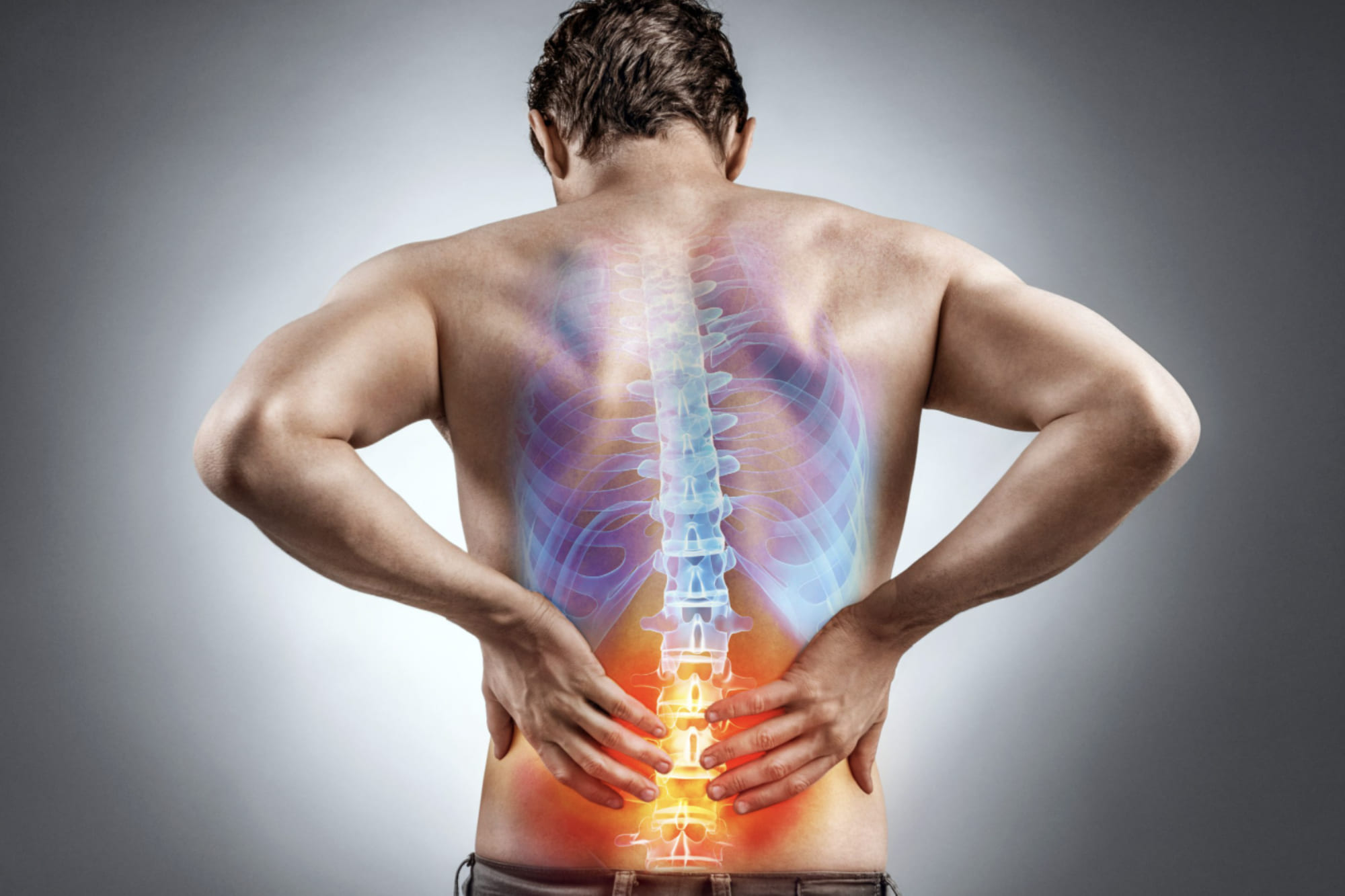 Espondiloartritis en CDMX