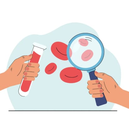 Síndrome de Anticuerpos Antifosfolípidos