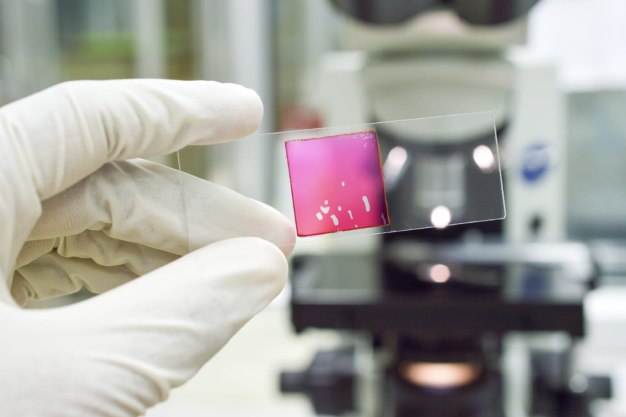 Toma de Biopsia de Glándula Salival